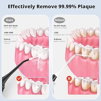 Portable Water Flosser — Deep Clean Anywhere, Anytime | The Complete Dental Travel Kit