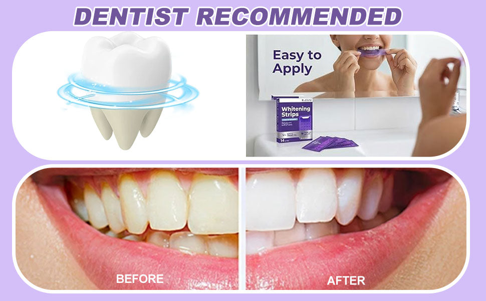 14 Daily Purple Whitening Strips — Peroxide-Free, Enamel-Safe for Sensitive Teeth